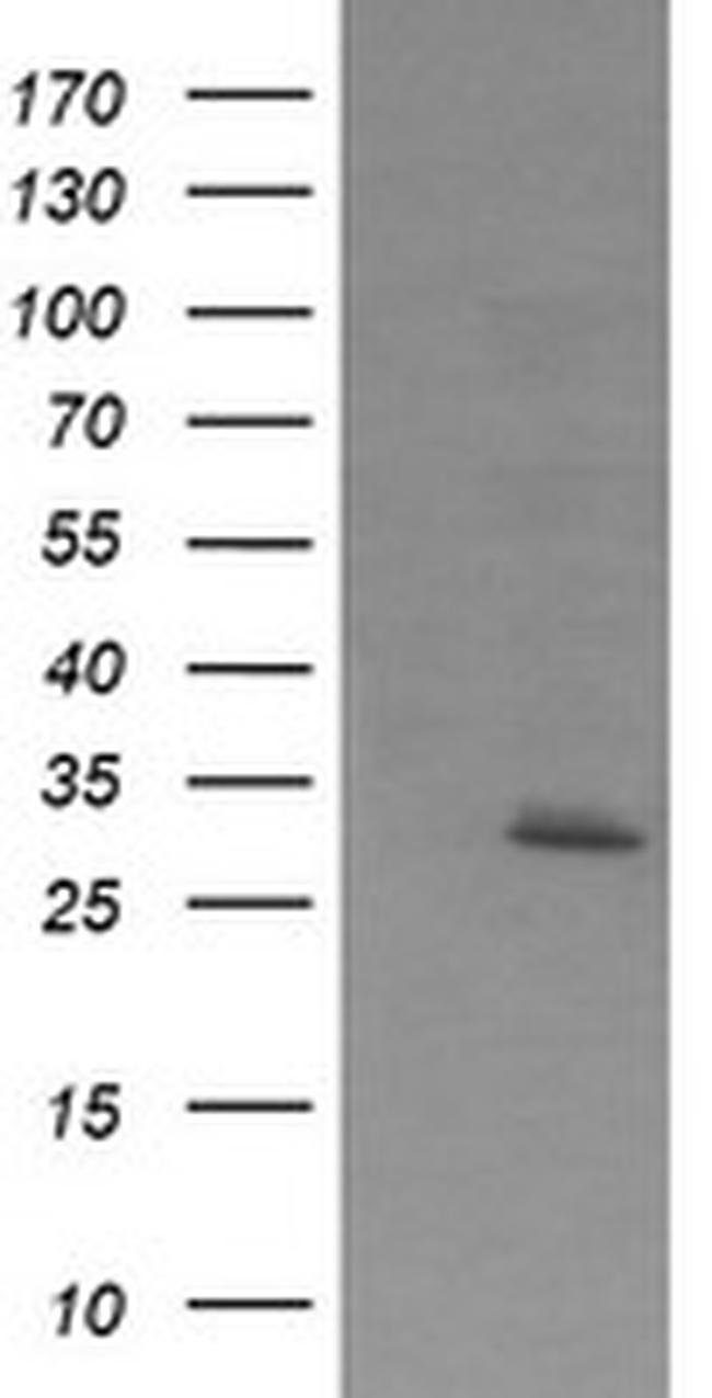 EXOSC7 Antibody in Western Blot (WB)