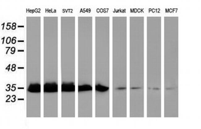 EXOSC7 Antibody in Western Blot (WB)