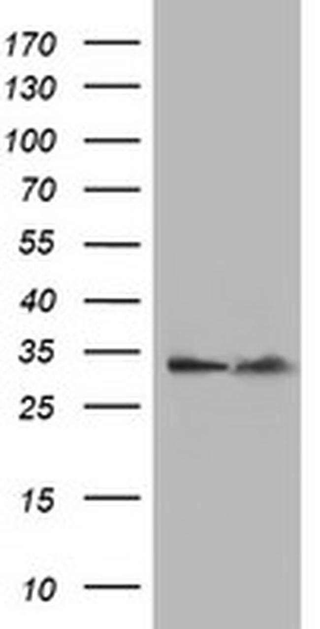 EXOSC7 Antibody in Western Blot (WB)