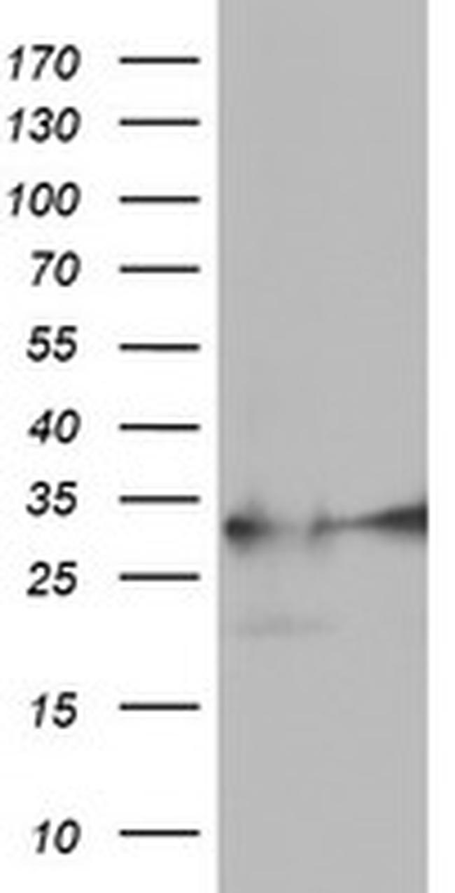 EXOSC7 Antibody in Western Blot (WB)