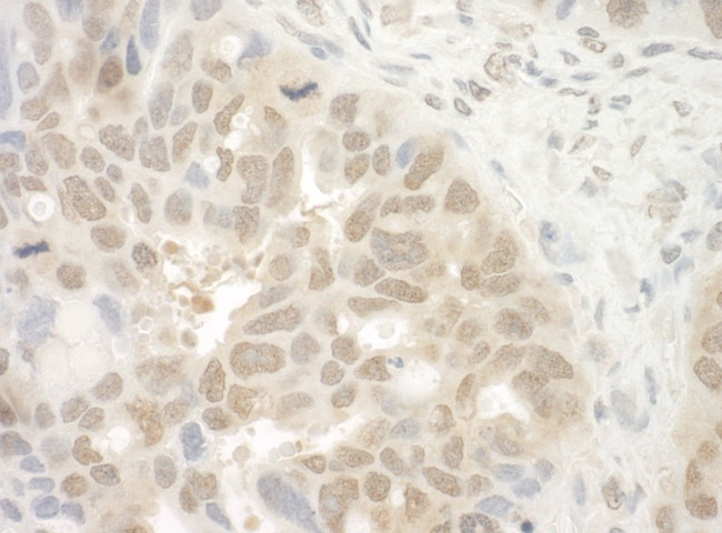 EYA4 Antibody in Immunohistochemistry (IHC)