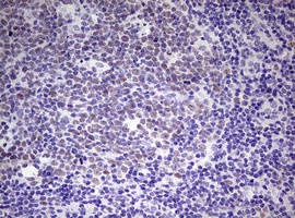 EZH2 Antibody in Immunohistochemistry (Paraffin) (IHC (P))