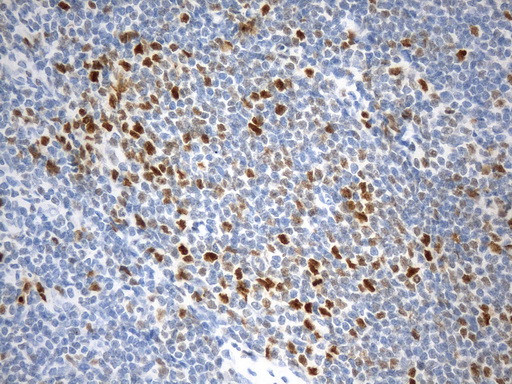 EZH2 Antibody in Immunohistochemistry (Paraffin) (IHC (P))