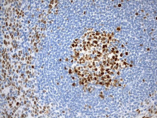 EZH2 Antibody in Immunohistochemistry (Paraffin) (IHC (P))