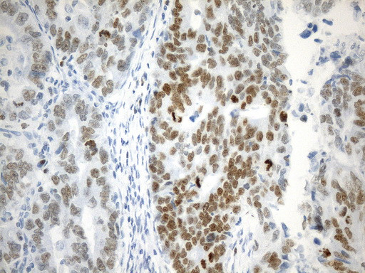 EZH2 Antibody in Immunohistochemistry (Paraffin) (IHC (P))