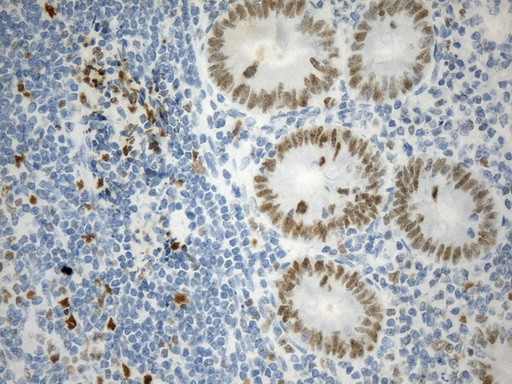 EZH2 Antibody in Immunohistochemistry (Paraffin) (IHC (P))