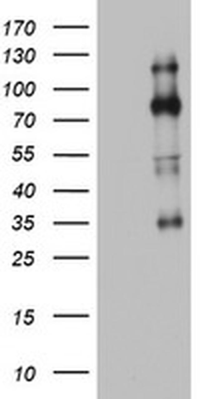 EZH2 Antibody in Western Blot (WB)