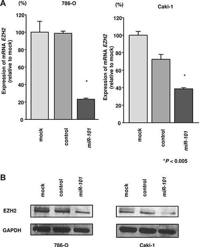 EZH2 Antibody in Western Blot (WB)