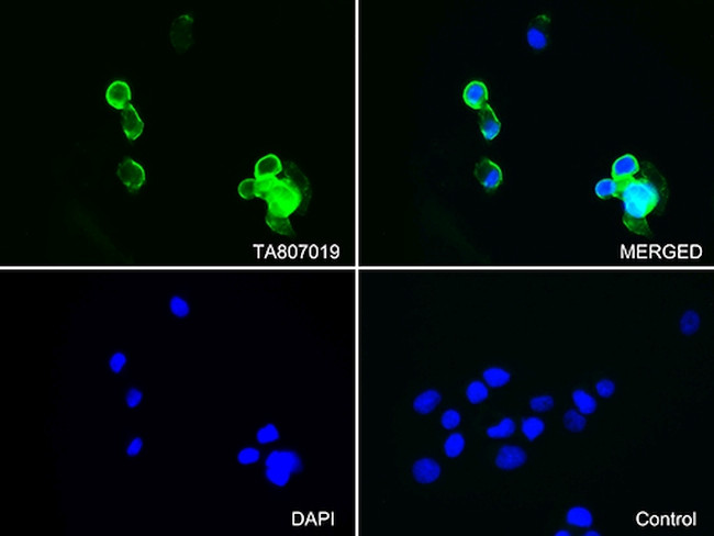 EZR Antibody in Immunocytochemistry (ICC/IF)