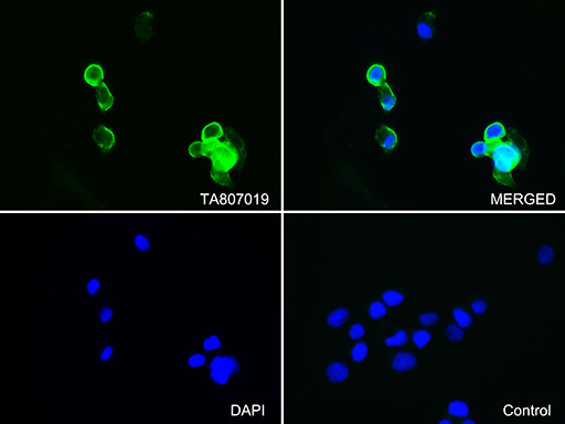 EZR Antibody in Immunocytochemistry (ICC/IF)