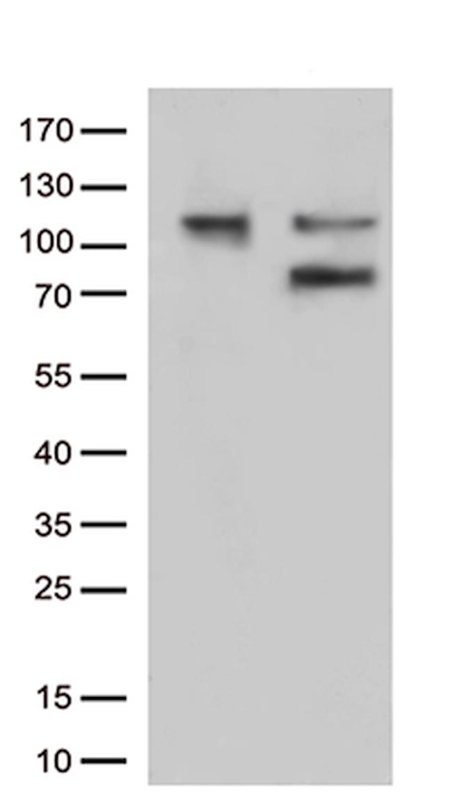 EZR Antibody in Western Blot (WB)