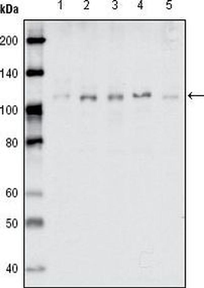 EphB1 Antibody in Western Blot (WB)