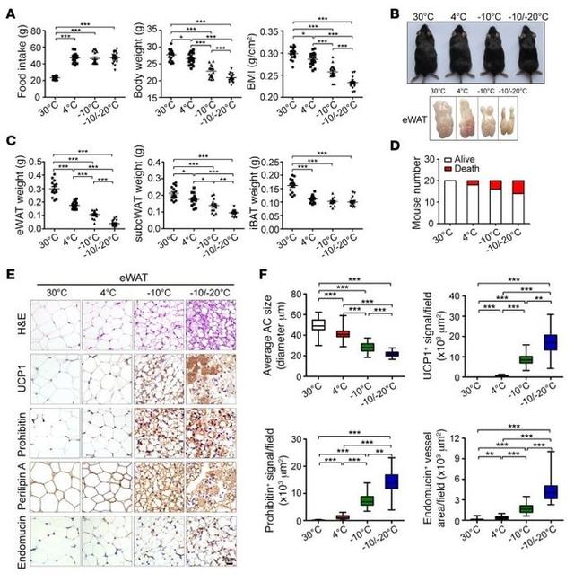 Endomucin Antibody in Immunohistochemistry (Paraffin) (IHC (P))