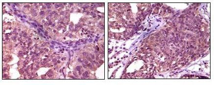 EphA1 Antibody in Immunohistochemistry (Paraffin) (IHC (P))