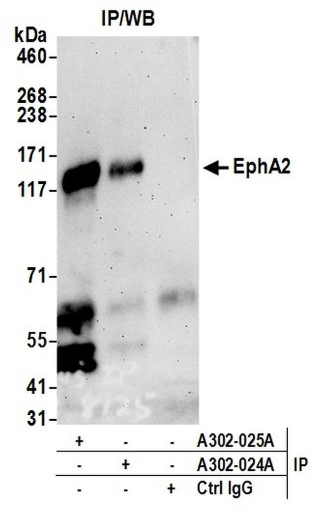 EphA2 Antibody in Western Blot (WB)