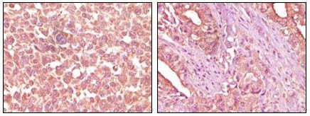 EphA2 Antibody in Immunohistochemistry (Paraffin) (IHC (P))