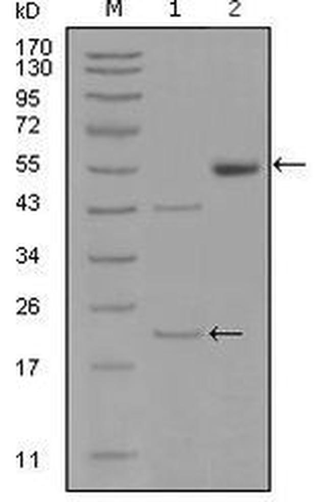 EphA5 Antibody in Western Blot (WB)