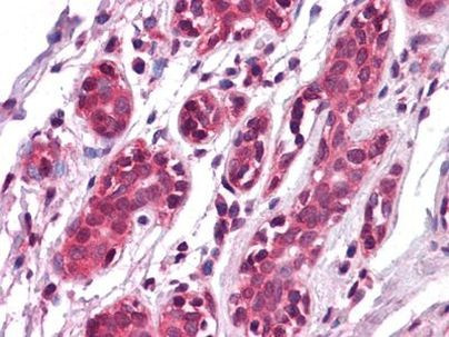 EphA7 Antibody in Immunohistochemistry (Paraffin) (IHC (P))