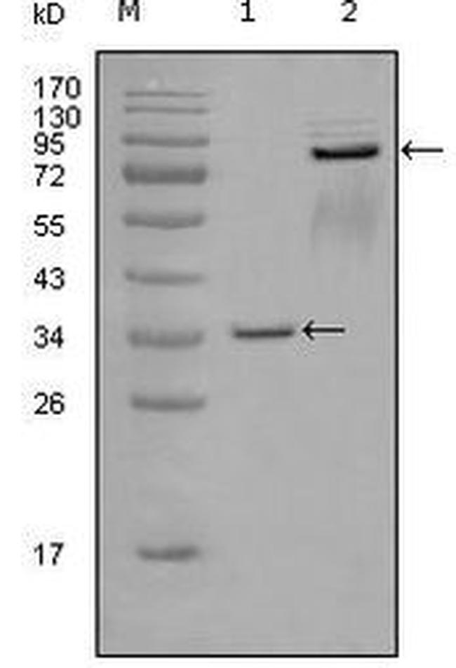 EphA7 Antibody in Western Blot (WB)