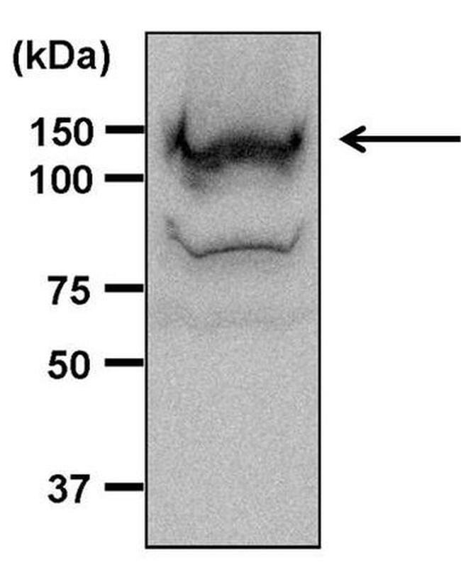 ERK5 Antibody in Western Blot (WB)