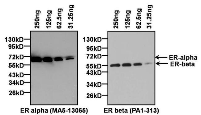 Estrogen Receptor alpha Antibody in Western Blot (WB)