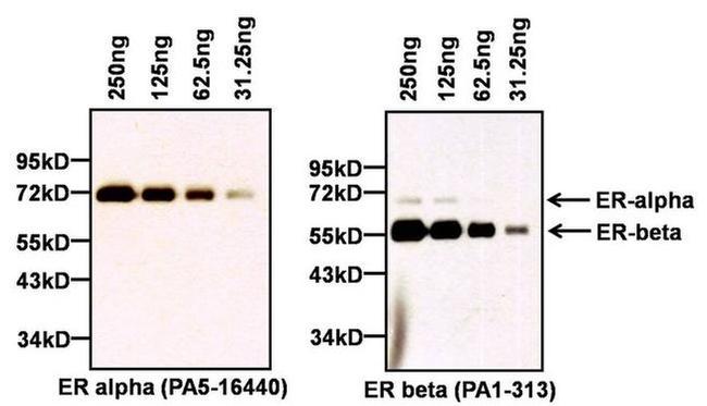 Estrogen Receptor alpha Antibody in Western Blot (WB)