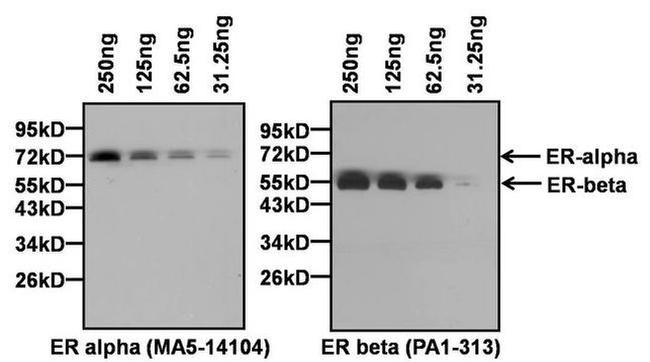 Estrogen Receptor alpha Antibody in Western Blot (WB)