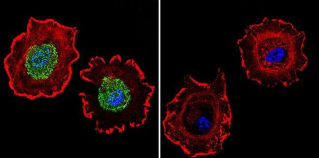 Estrogen Receptor alpha Antibody in Immunocytochemistry (ICC/IF)