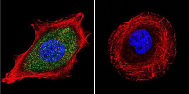 Estrogen Receptor alpha Antibody in Immunocytochemistry (ICC/IF)