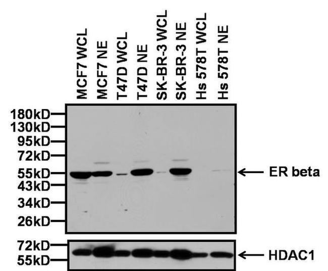 Estrogen Receptor beta Antibody in Western Blot (WB)