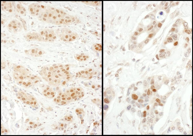 Exportin-5 Antibody in Immunohistochemistry (IHC)