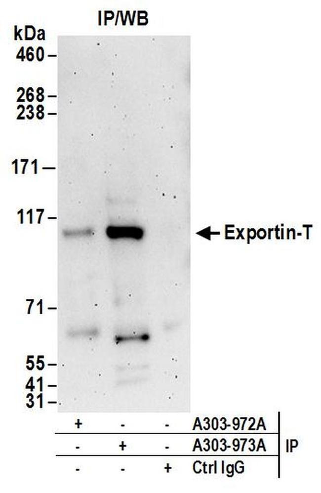 Exportin-T Antibody in Western Blot (WB)