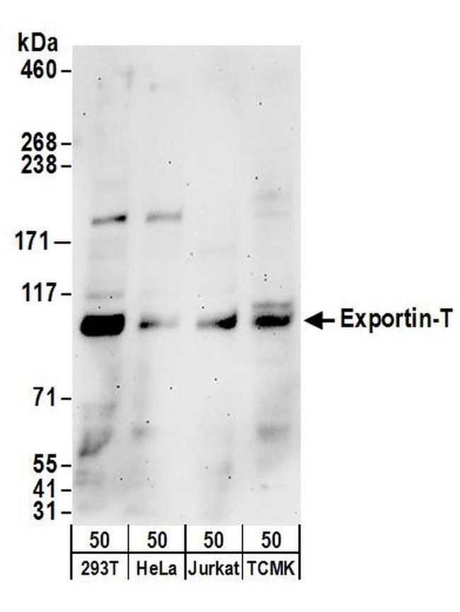 Exportin-T Antibody in Western Blot (WB)