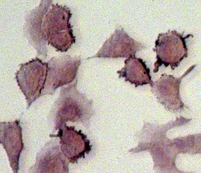 Ezrin Antibody in Immunocytochemistry (ICC/IF)