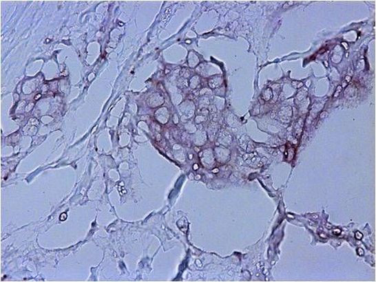 Ezrin Antibody in Immunohistochemistry (Paraffin) (IHC (P))