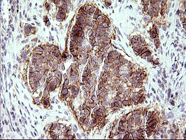 F11R Antibody in Immunohistochemistry (Paraffin) (IHC (P))