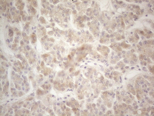 F12 Antibody in Immunohistochemistry (Paraffin) (IHC (P))