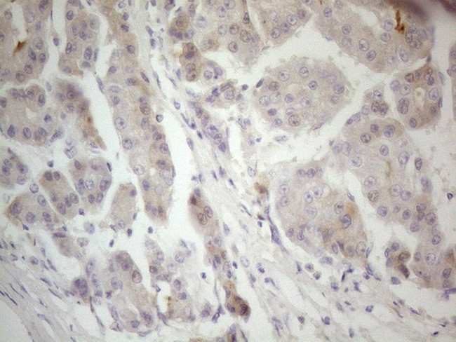 F12 Antibody in Immunohistochemistry (Paraffin) (IHC (P))