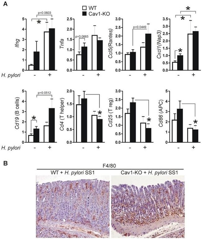 F4/80 Antibody in Immunohistochemistry (IHC)