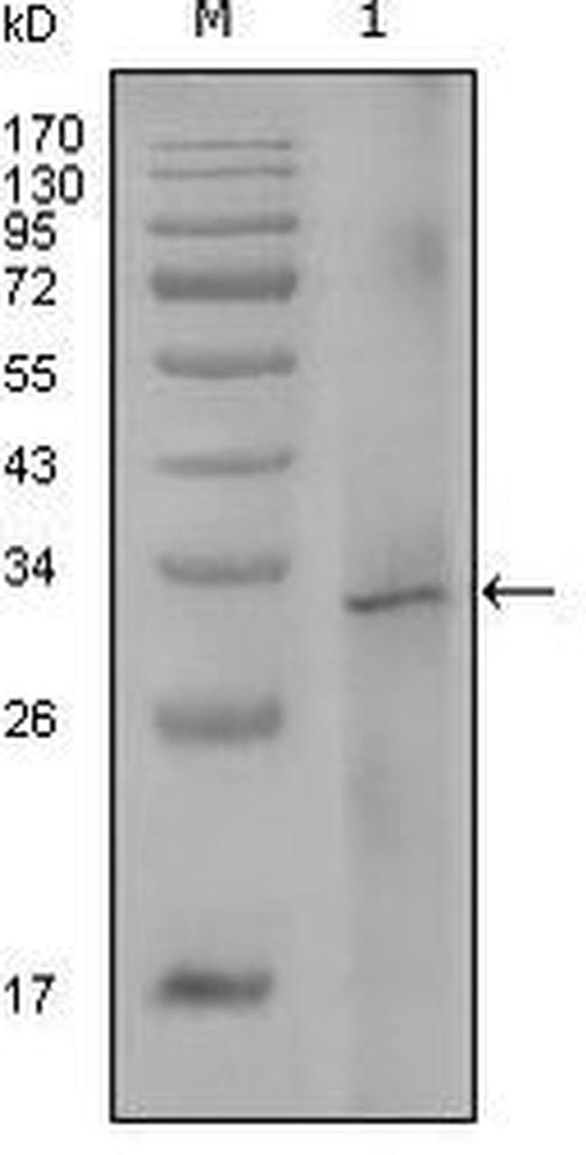 Factor VIII Antibody in Western Blot (WB)