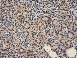 FABP2 Antibody in Immunohistochemistry (Paraffin) (IHC (P))