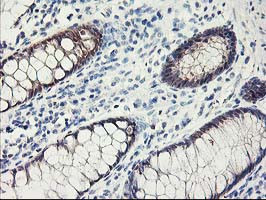 FABP2 Antibody in Immunohistochemistry (Paraffin) (IHC (P))