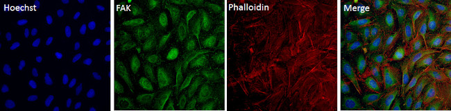 FAK Antibody in Immunocytochemistry (ICC/IF)