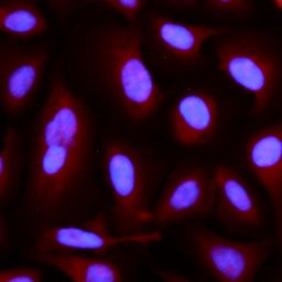 FAK Antibody in Immunocytochemistry (ICC/IF)