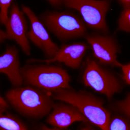 FAK Antibody in Immunocytochemistry (ICC/IF)