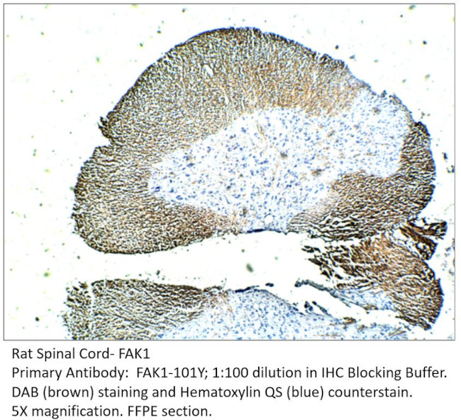 FAK1 Antibody in Immunohistochemistry (IHC)