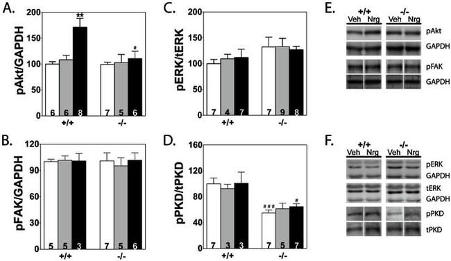 Phospho-FAK (Tyr861) Antibody in Western Blot (WB)