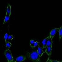 FAK Antibody in Immunocytochemistry (ICC/IF)