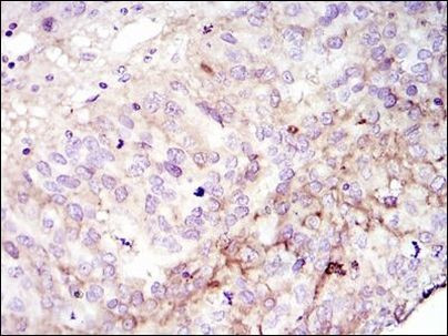 FAK Antibody in Immunohistochemistry (Paraffin) (IHC (P))