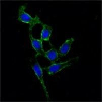 FAK Antibody in Immunocytochemistry (ICC/IF)